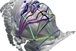 2020 04 29 15 11 6222 2020 05 01 Jcsm 3 D Face Scan 400