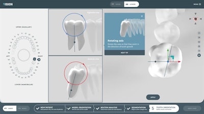 SoftSmile's new aligner software for orthodontists includes automated detection of tooth axis. Image courtesy of SoftSmile.