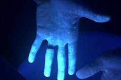 2020 05 08 17 05 8535 2020 05 11 Uv Ppe Aerosol Hands 20200508174702