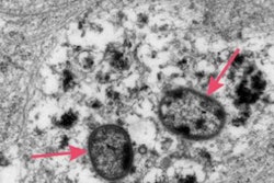 2020 05 14 18 33 5086 2020 05 15 Pgingivalis 20200514183458