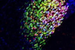 2020 05 20 17 26 1785 2020 05 21 Neurons Pain 20200520171752