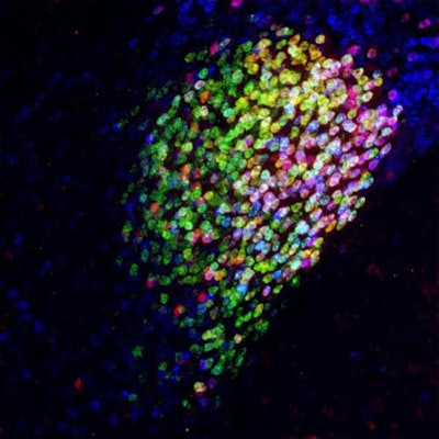 Neuron cells in the central amygdala in the brain of a mouse. Red, magenta, and yellow cells are part of a collection of neurons activated by general anesthesia that has strong pain-suppression abilities. Image courtesy of Fan Wang Lab - Duke University Medical Center.