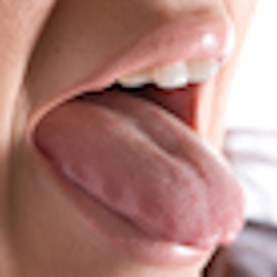 2020 05 21 18 58 0471 Tongue 400