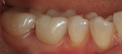 2020 06 13 00 18 0225 2020 06 16 Aadland Image2 20200613000828