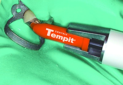 Tempit-E. Image courtesy of Centrix.