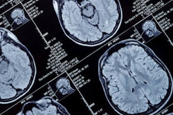 2020 06 19 16 16 8156 Mri Brain Head 400