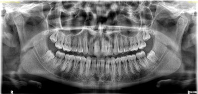 New Tomosharp technology. Image courtesy of Lea Al Matny, DDS.