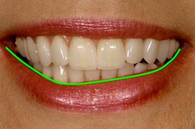 All images courtesy of David Rice, DDS.