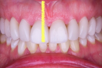 Mouth showing smile