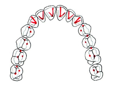Diagram of teeth