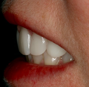 Profile of person