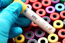 2020 07 21 15 41 5665 Lab Hiv Test 400