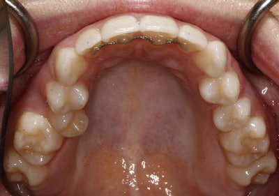 All images courtesy of Bill Dischinger, DMD.