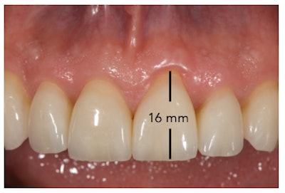 2020 07 29 22 28 8994 2020 07 31 Rice Veneer2