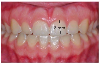 2020 07 29 22 28 9150 2020 07 31 Rice Veneer3