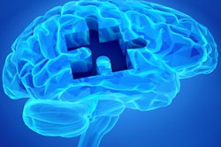 2020 07 31 17 52 6902 Brain Puzzle Dementia 400