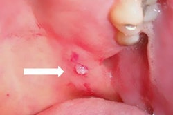 2020 07 31 23 12 6950 2020 08 Laser Oral Surgery One 20200731233516