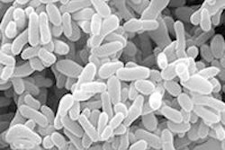 2020 08 24 20 25 8704 Bacteria Gardnerella Vaginalis 200