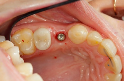 All images courtesy of David Rice, DDS.