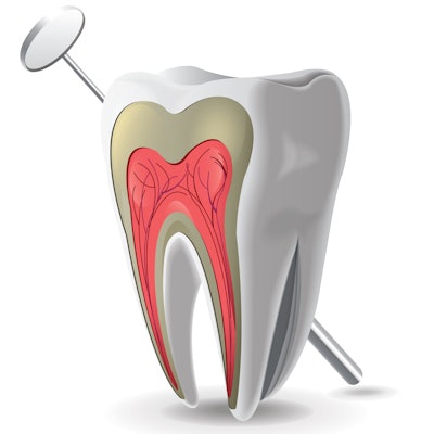 2016 10 04 13 57 40 48 Tooth Pulp Endodontic 400