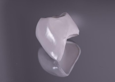 Figure 4: Luster achieved after completion of prepolishing prior to sintering.