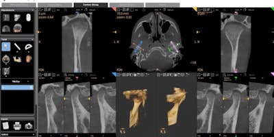 All images courtesy of Dr. Lea Al Matny.