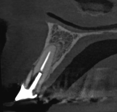 Image courtesy of Lea Al Matny, DDS