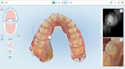 Image courtesy of Align.