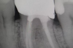 2020 10 12 17 45 2456 2020 10 15 Insider After Xray 20201012172425