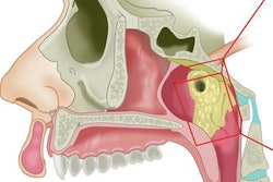 2020 10 26 22 11 2001 2020 10 27 Salivary Glands 2 Large 20201026225154
