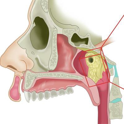 2020 10 26 22 11 2001 2020 10 27 Salivary Glands 2 Large 20201026225154