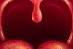 2017 04 17 14 54 21 793 Uvula Tongue Tonsils 400