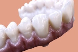 2020 11 04 22 39 7733 Nobel Biocare Bridge 400