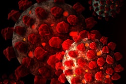 2020 03 24 17 26 7956 Virus Coronavirus Sars Co V 2 400