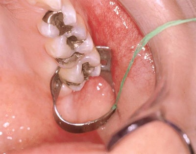 All images courtesy of Dr. Joe Blaes.