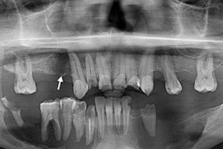 2020 12 08 23 23 9688 2020 12 09 Lch Jaw 400