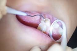 2020 01 23 22 58 1468 Dental Exam Child Sealant 400