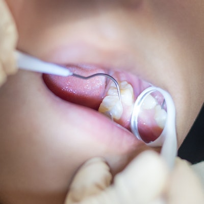 2020 01 23 22 58 1468 Dental Exam Child Sealant 400