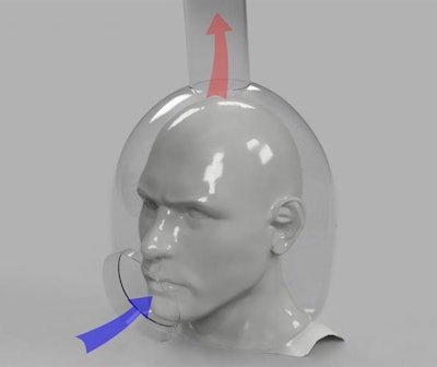 An open-faced helmet for patients could minimize the spread of infectious diseases such as COVID-19, researchers believe. Image courtesy of Dongjie Jia, PhD.