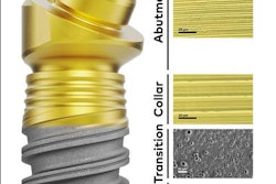 2021 01 13 00 55 2499 2021 01 12 Nobel Implant 20210113000738 20210113000814