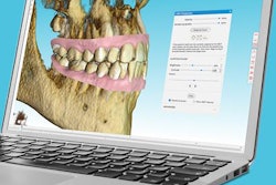 2021 01 15 00 59 7234 2021 01 14 Spark Aligner 20210115003726