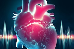 2021 01 29 22 24 0556 Cardiac Heart Eeg 400