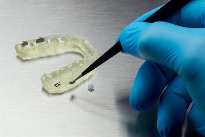 The indirect bonding tray resin. All images courtesy of Formlabs.