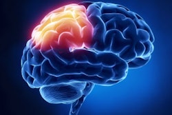 2019 08 15 00 02 7337 Brain 400