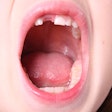 2020 03 23 18 23 5325 Kid Open Mouth 400
