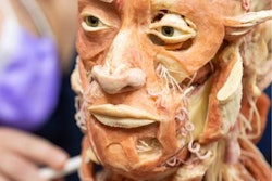 2021 03 11 21 31 8130 2021 03 12 Plastinated Head 2 20210311211833