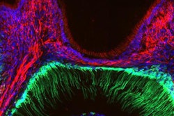 2021 03 26 22 15 5472 2021 03 29 Cold Teeth 20210326224459