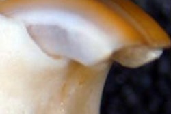 2021 03 31 16 29 3358 2021 03 30 Tooth Regeneration 400