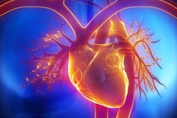 2021 04 19 19 11 0834 Heart Pulmonary Trunk 400