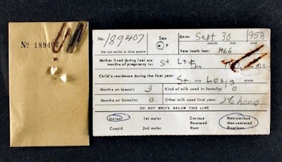 A baby tooth donated to the Baby Tooth Survey in St. Louis and the donor's information card. All images courtesy of Weisskopf.